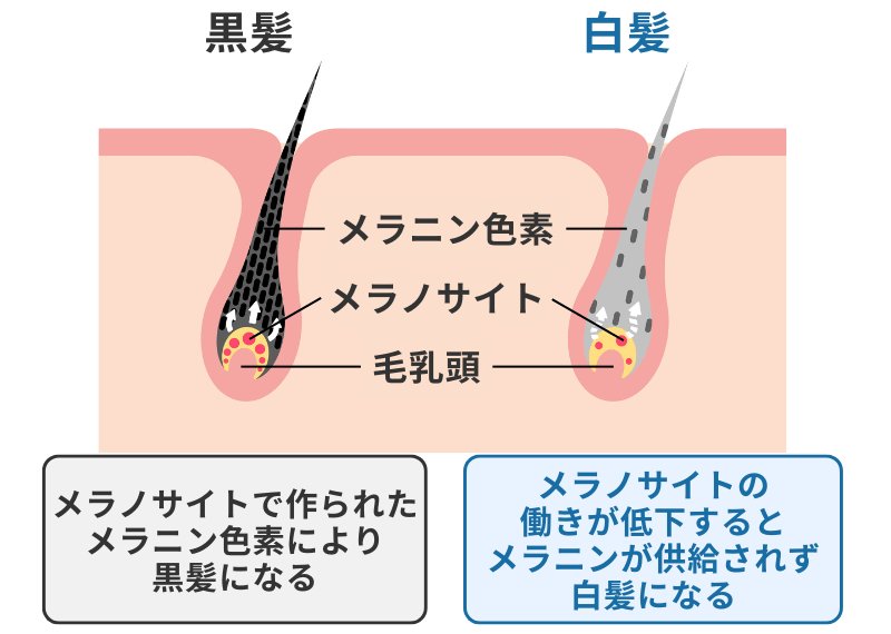 黒髪と白髪の違い
